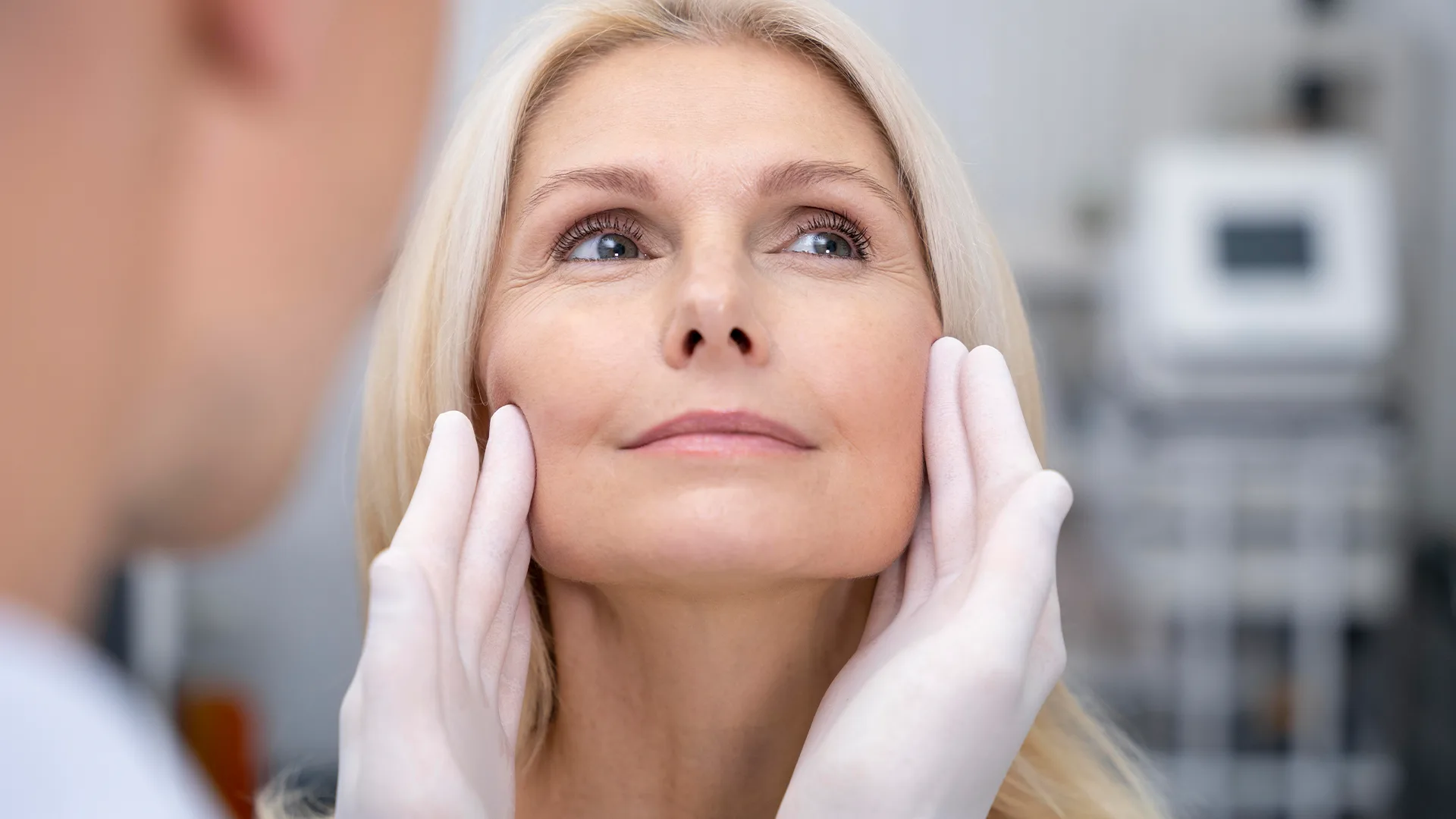 facelift
