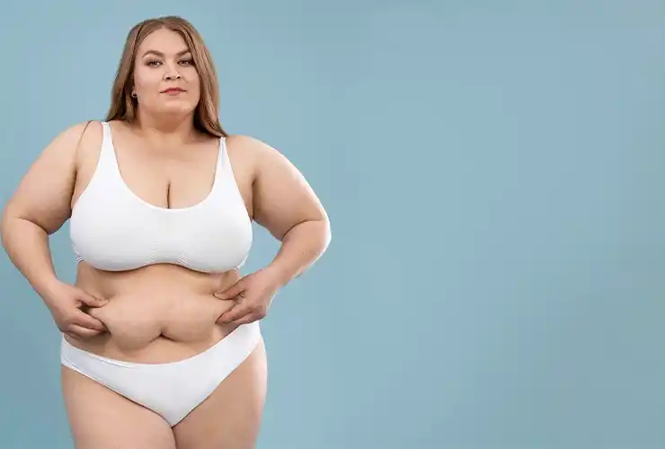 obesity
